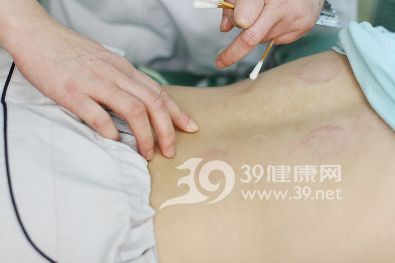ᘹ޷ָᘴcιϵίᘹ޵Чι޵Чԏ(qing)mҪ^Ҋ(jin)ЧĻ